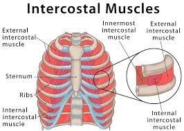 intercostal-muscle-strain